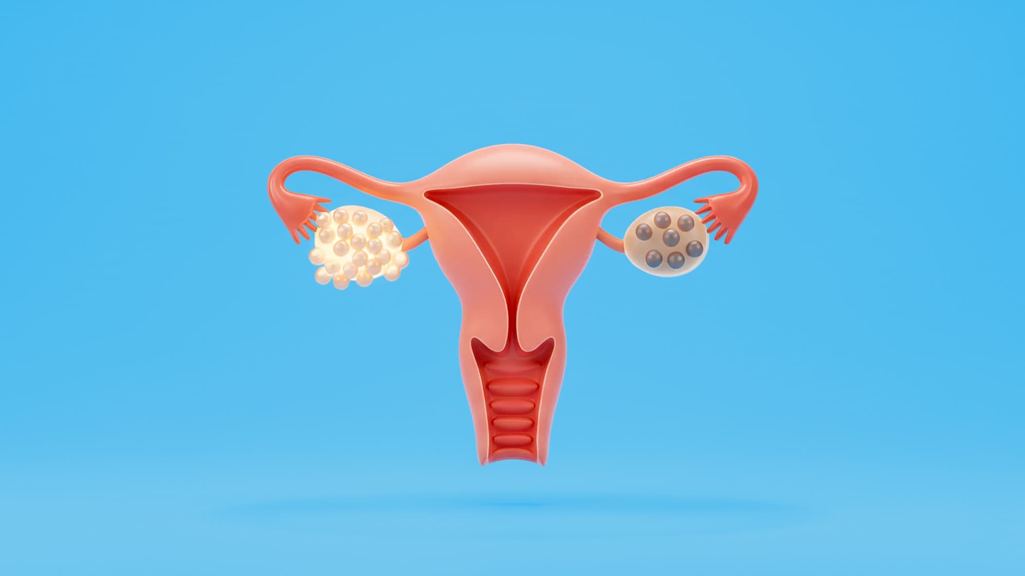 Female reproductive system illustration showing ovaries with reduced egg count and fewer visible follicles, representing low AMH and diminished ovarian reserve