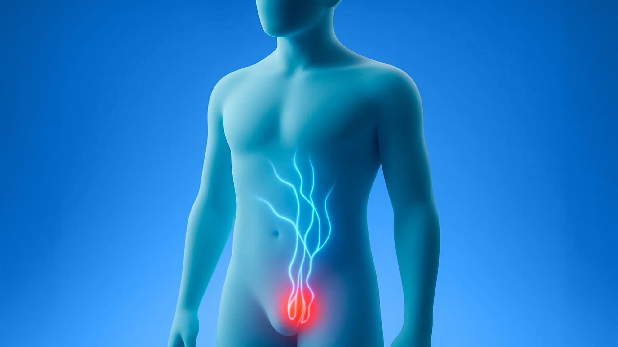 Male reproductive system illustration highlighting varicocele with pain and enlarged veins in the scrotum affecting fertility.