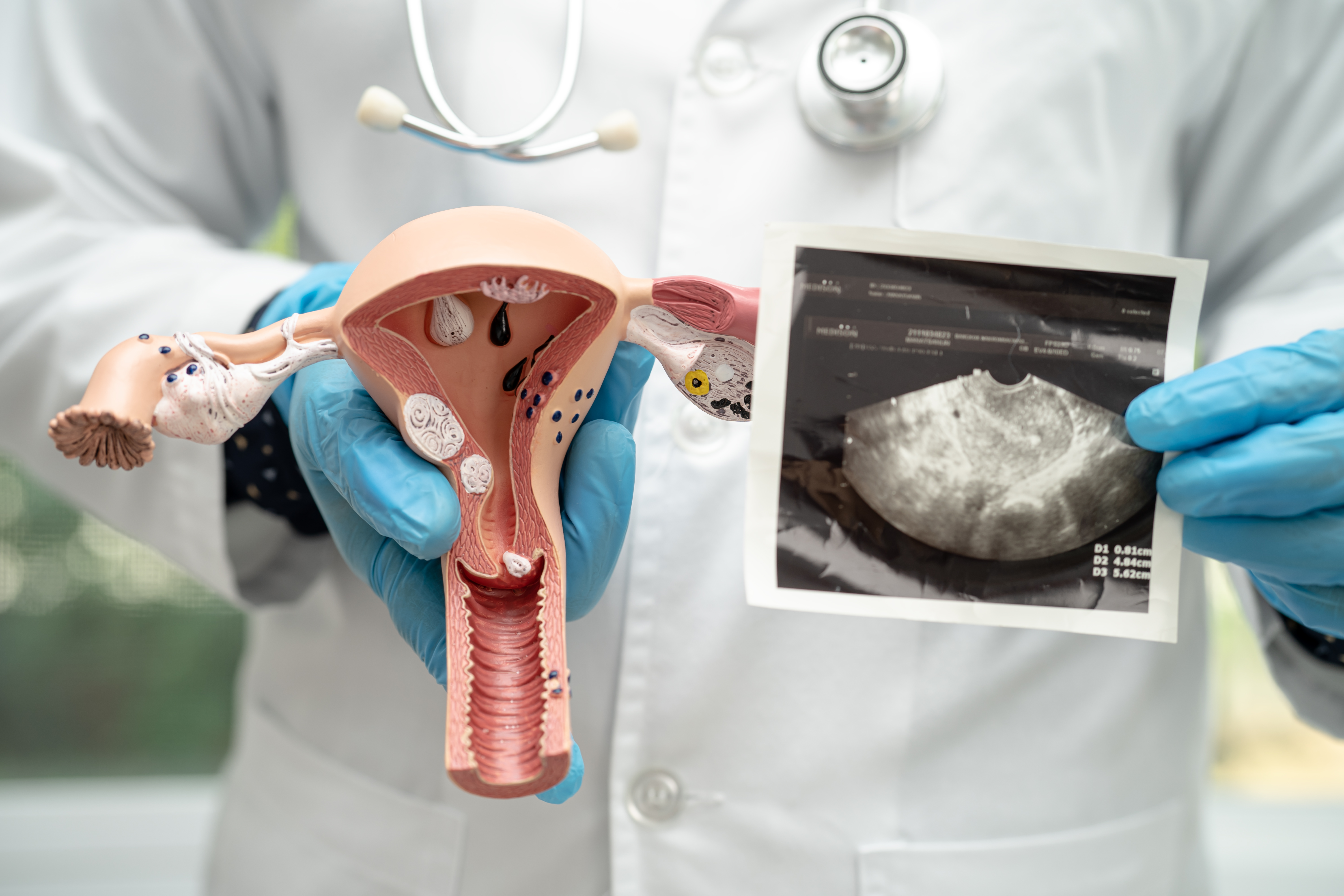 IUI intra-uterine insemination process visual for HomeIVF